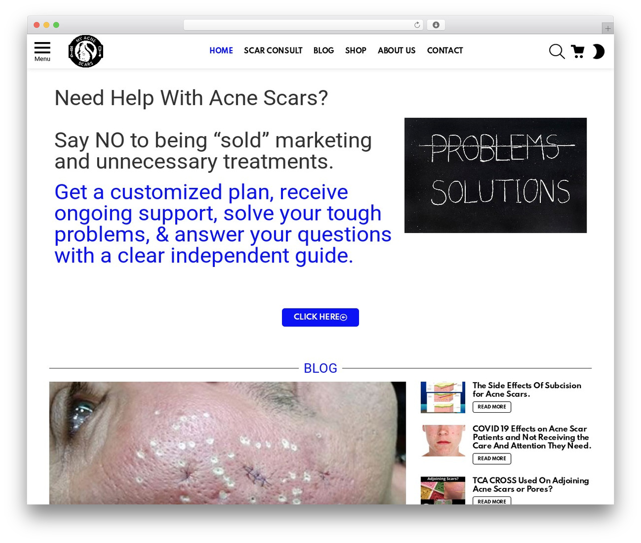 Bimber theme WordPress - myacnescars.com Bimber theme WordPress - myacnescars.com