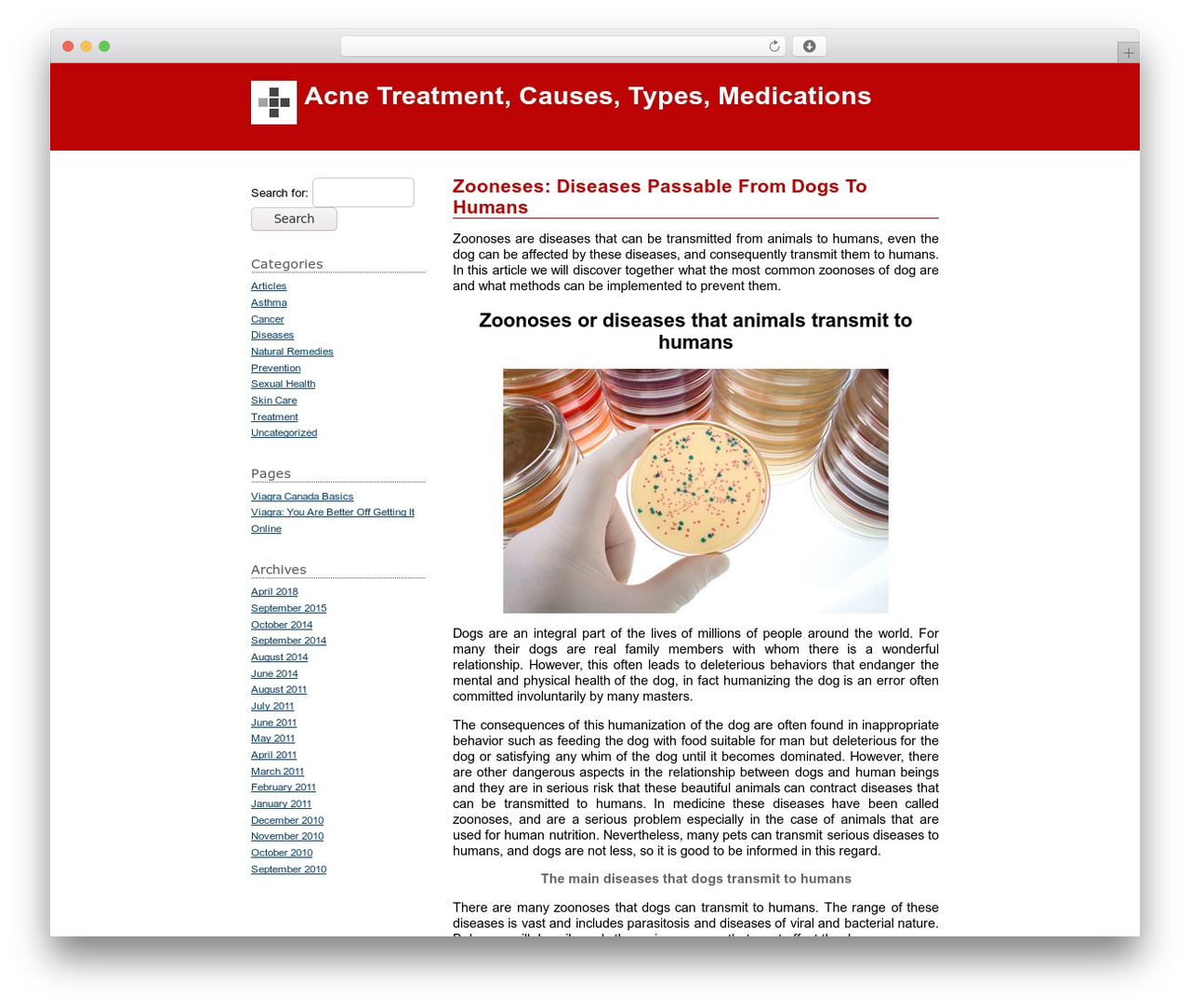 Theme WordPress NotesIL - acnetreatment-methods.com