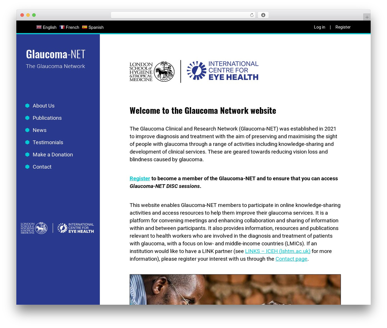 Theme WordPress Accessible Theme Bootstrap 4 - glaucoma-network.org Theme WordPress Accessible Theme Bootstrap 4 - glaucoma-network.org