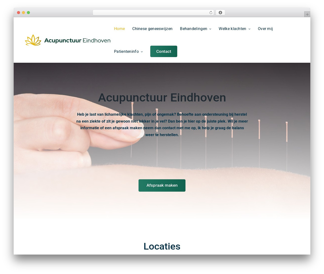 Creatus top WordPress theme - acupunctuureindhoven.nl Creatus top WordPress theme - acupunctuureindhoven.nl