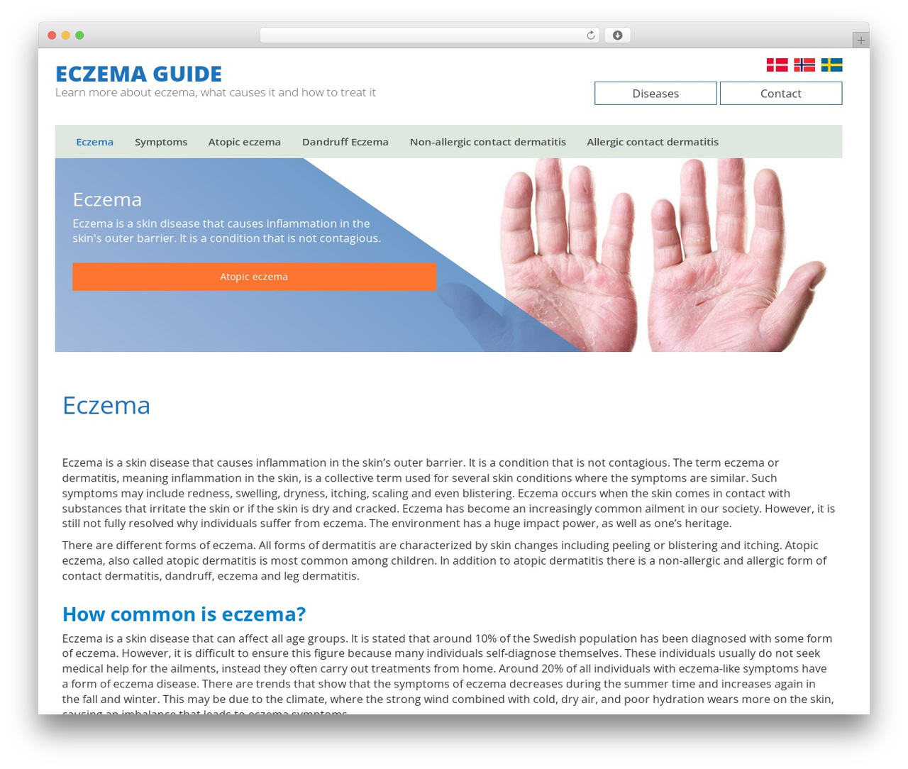 WP theme Bioglan Bootstrap Basic - eczemaguide.eu