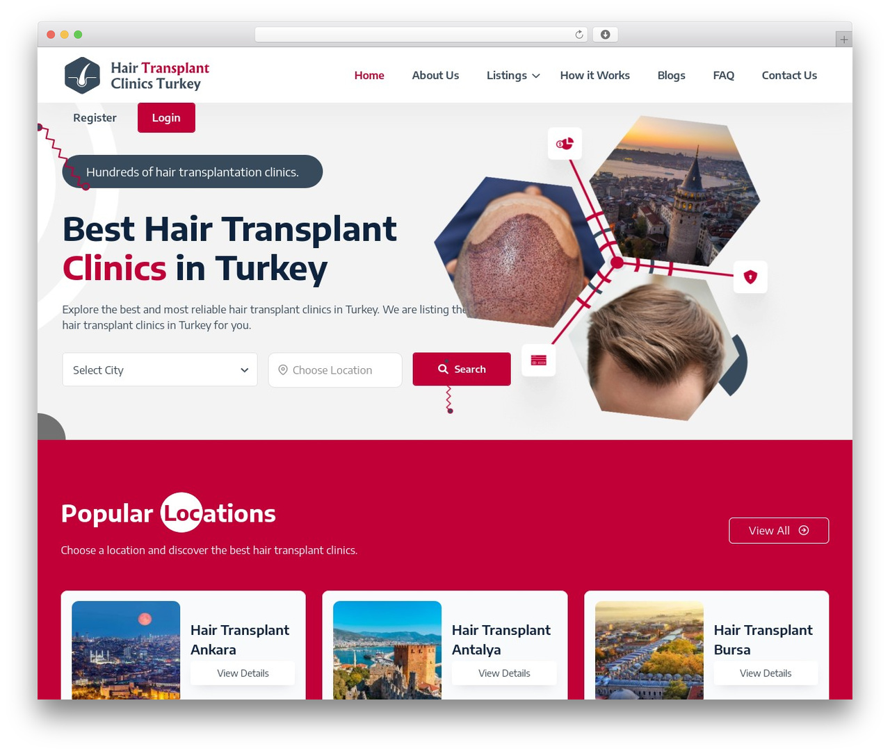 Listee WordPress theme - www.hairtransplantclinicsturkey.com Listee WordPress theme - www.hairtransplantclinicsturkey.com
