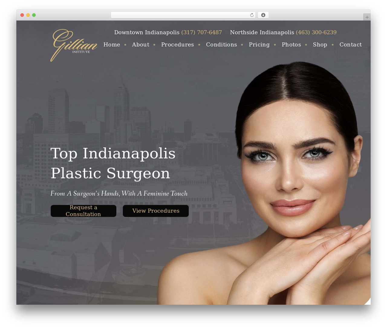 incredibletheme WordPress theme - indyplasticsurgery.com