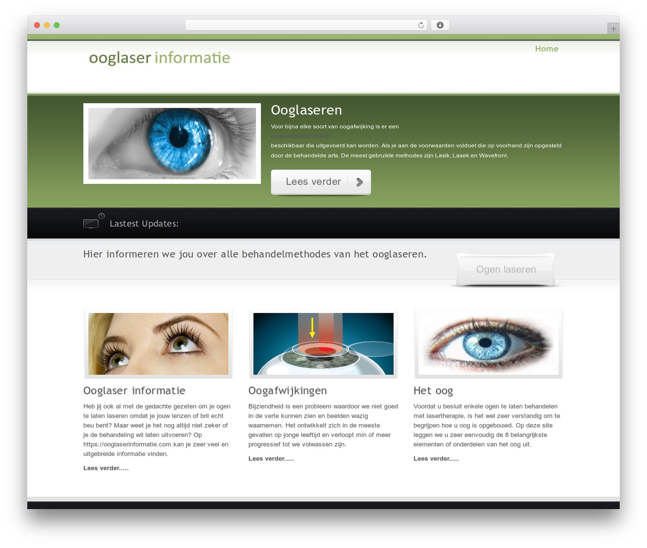 OverALL WordPress Theme top WordPress theme - ooglaserinformatie.com