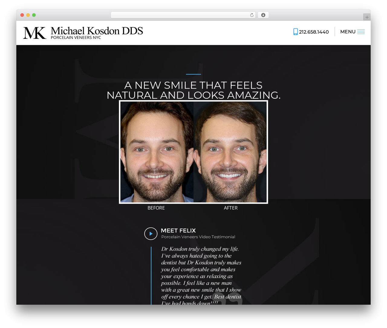 Theme WordPress RM Theme - www.veneers.nyc Theme WordPress RM Theme - www.veneers.nyc