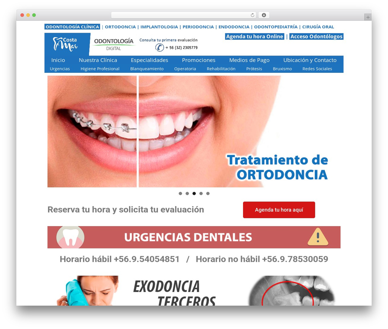 Theme WordPress GeneratePress - costamarodontologia.cl Theme WordPress GeneratePress - costamarodontologia.cl