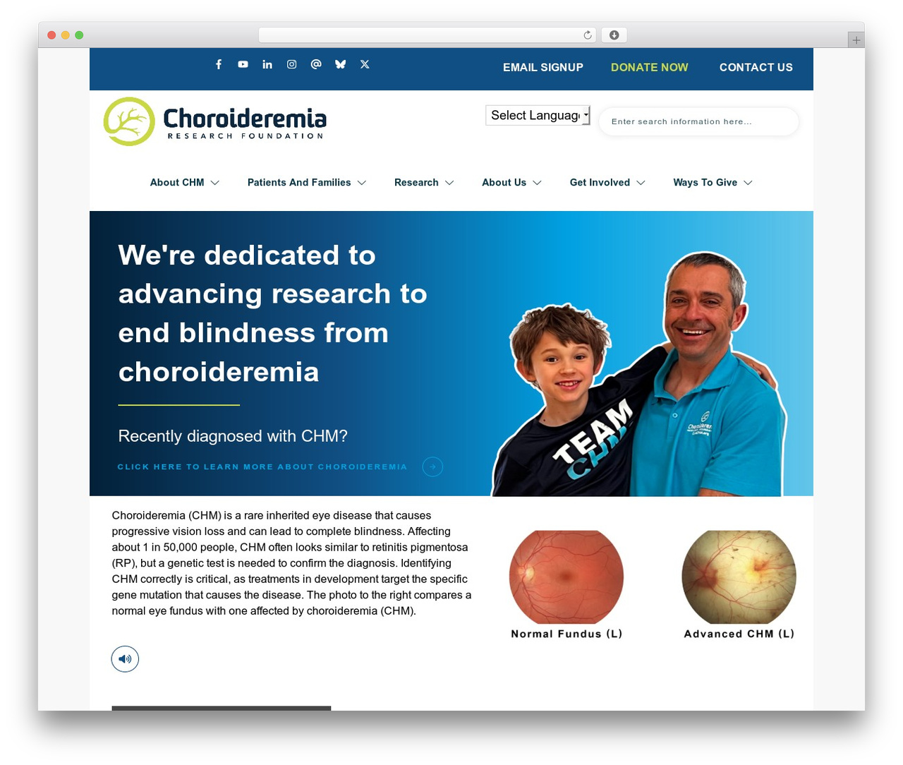 Theme WordPress Thrive Theme Builder - curechm.org Theme WordPress Thrive Theme Builder - curechm.org