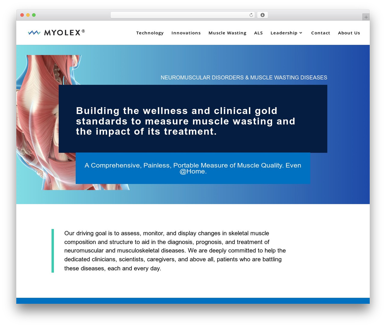 WordPress theme Divi - myolex.com