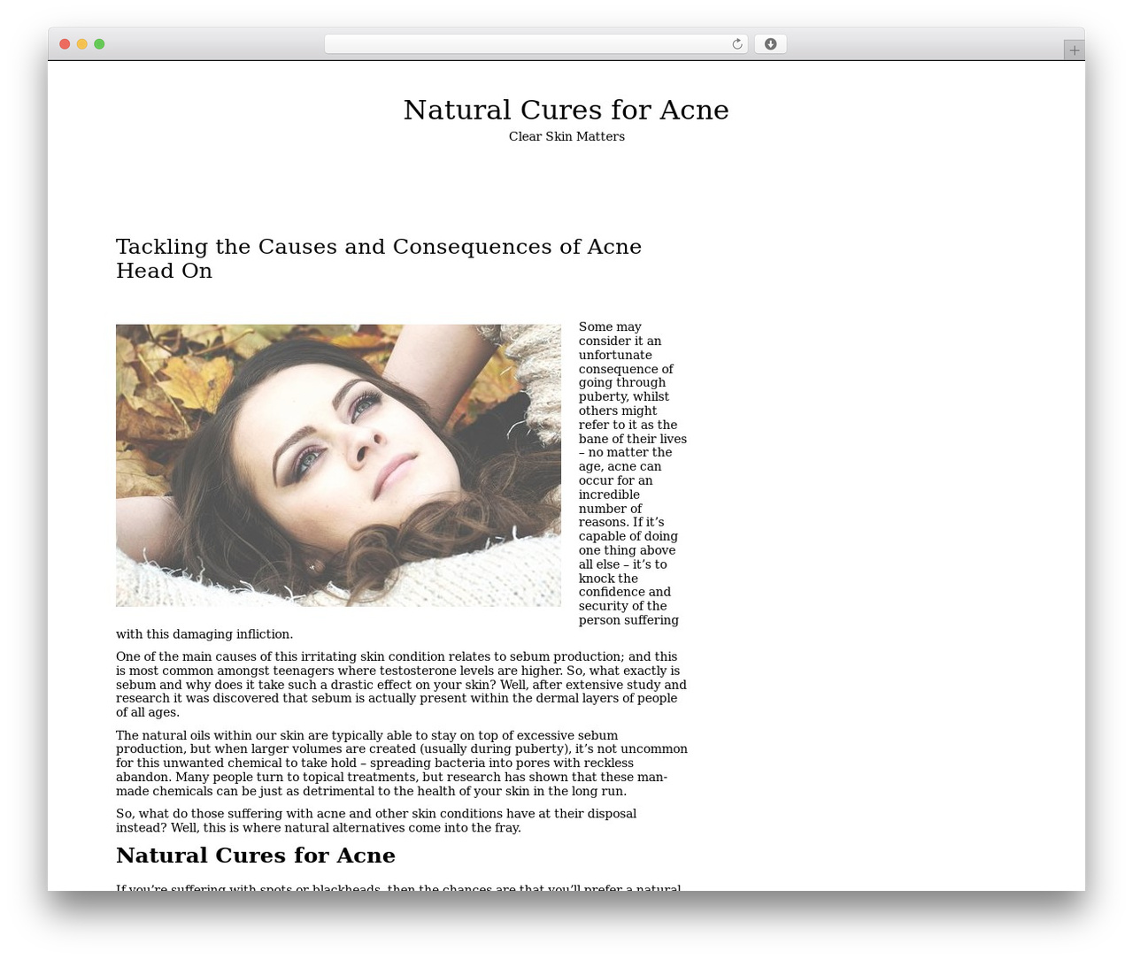 Writee WP theme - naturalcuresforacne.com