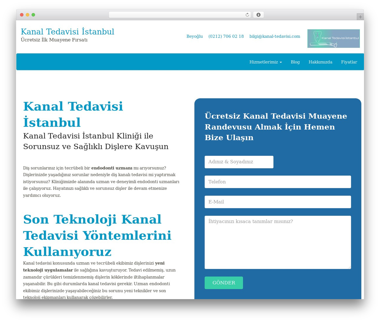 Best WordPress theme Leadinjection - kanal-tedavisi.com Best WordPress theme Leadinjection - kanal-tedavisi.com