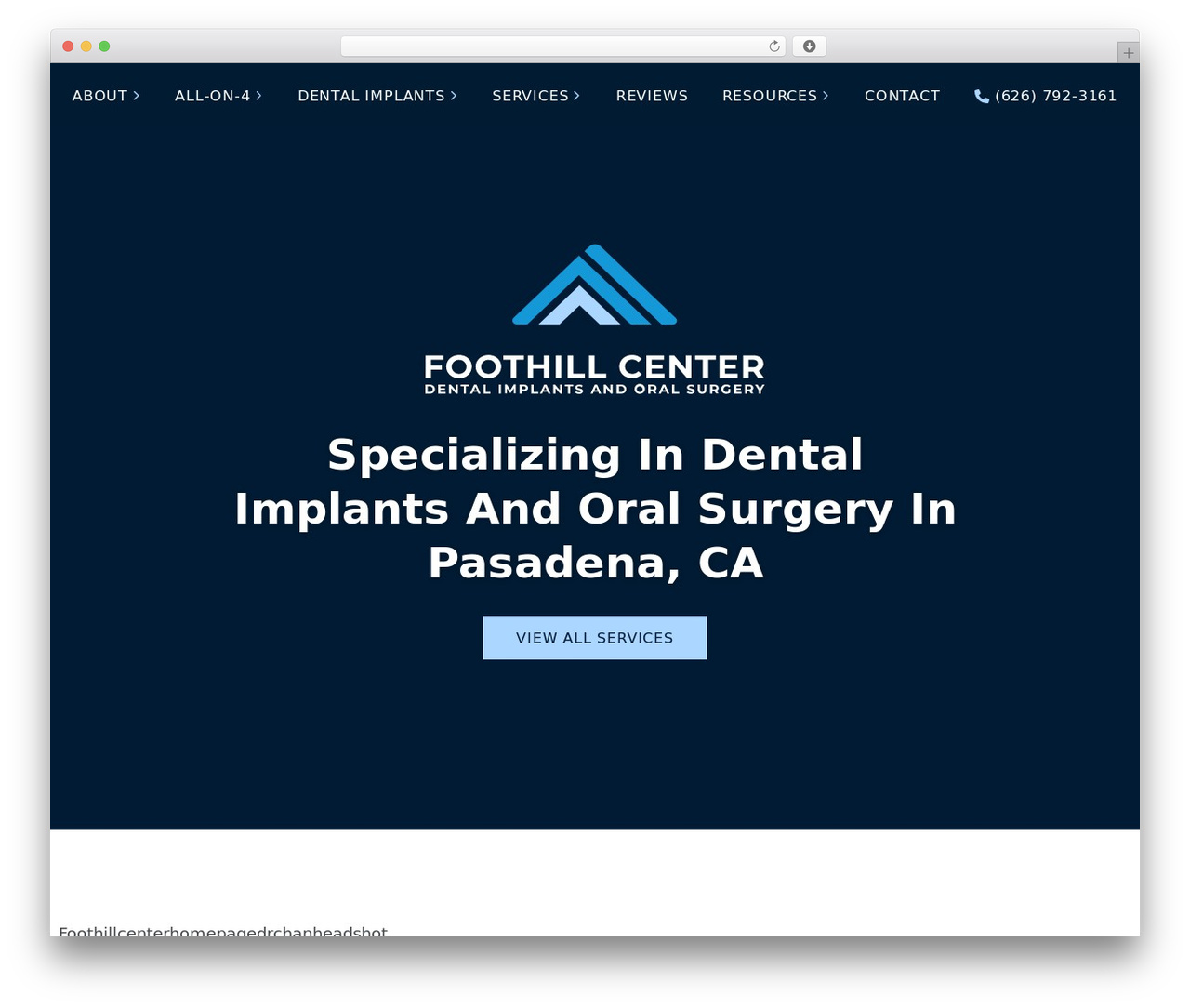 FMBuildr 5 WordPress theme - foothilldentalimplants.com